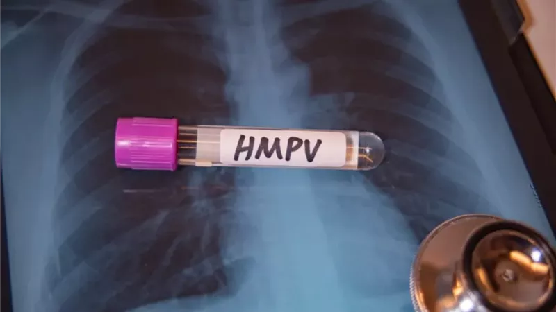 يشبه الإنفلونزا وليس له علاج.. ماذا نعرف عن انتشار فيروس HMPV؟