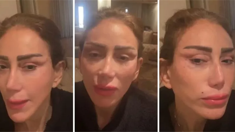 إحالة طبيب تجميل لبنانى للجنايات بواقعة تشويه وجه ريهام سعيد والتشهير بها