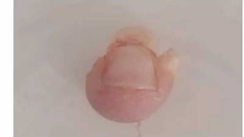 إصابة طفل داخل حضانة خاصة.. ووالده: 