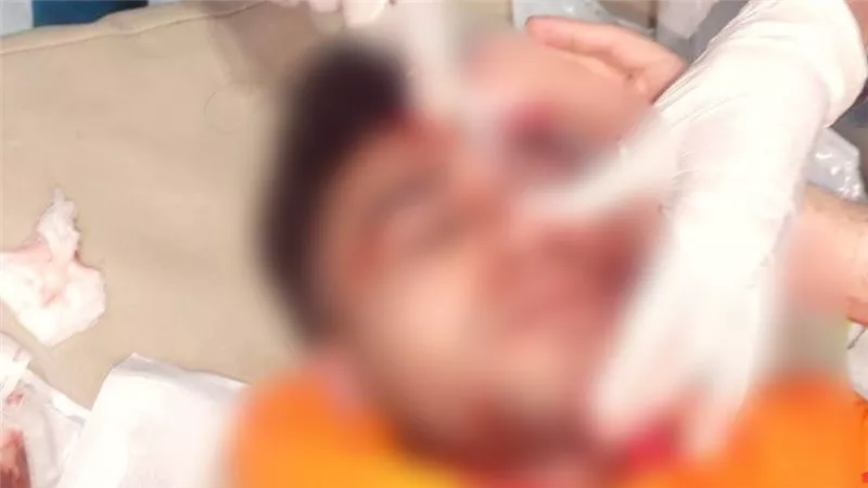 إصابة طالب بكسر في الجمجمة بعد اعتداء خلال السحور بالغردقة