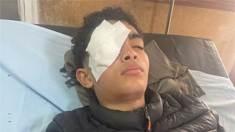 لعب عيال قلب بمأساة.. تفاصيل فقد طالب عينه بسبب صواريخ رمضان 