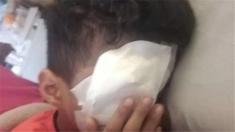 انفجار عين طفل بسبب الألعاب النارية في الوادي الجديد