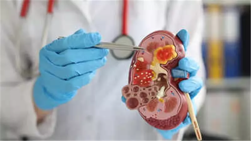 9 عادات تمارسها يوميا تسبب الإضرار بالكلى.. يجب الإبتعاد عنها فورا
