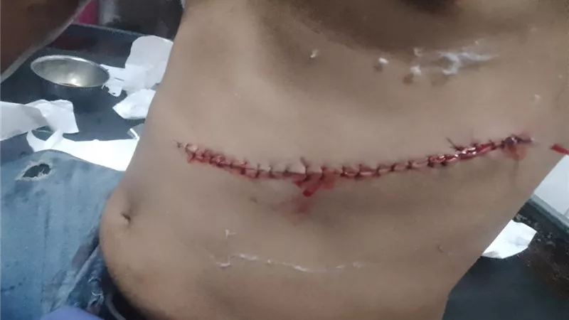 70 غرزة في البطن و24 بالذراعين.. تفاصيل الاعتداء على مواطن بالأسلحة البيضاء بالزقازيق
