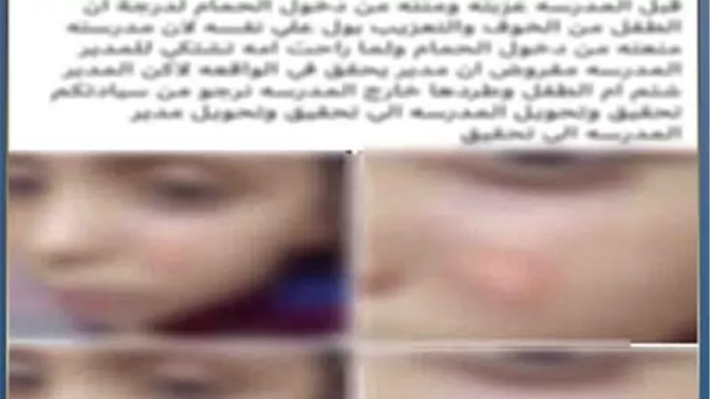 ضبط مدرسة بسوهاج بعد اتهامها بالتعدي على طالب وإصابته بـ«ولاعة»