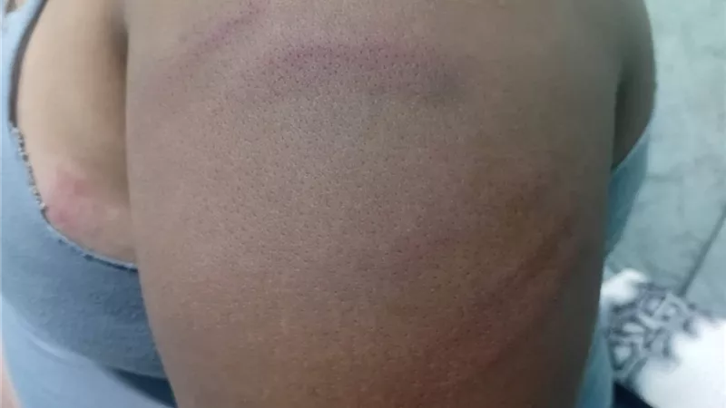 ضرب طالب داخل مدرسة منطي الإعدادية في القليوبية.. ووالدته تطالب بمراجعة الكاميرات 