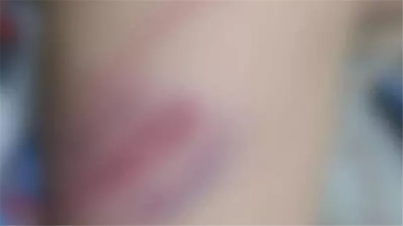 جد يتهم مدرسًا بالتعدي على حفيده بالضرب داخل سنتر دروس خصوصية في البحيرة