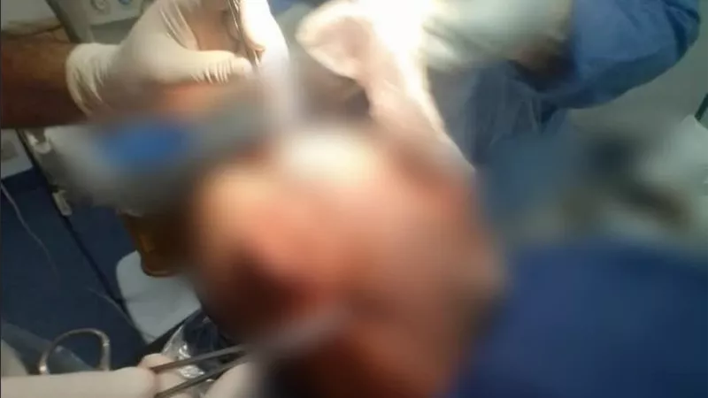 نجاح مستشفى مغاغة بالمنيا في استئصال ورم جلدي بفروة رأس مسن وإنهاء معاناته