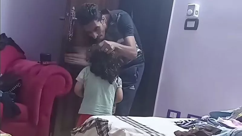 الأمن يفحص فيديو الاعتداء على طفل وإشعال النار في شعره وجسده