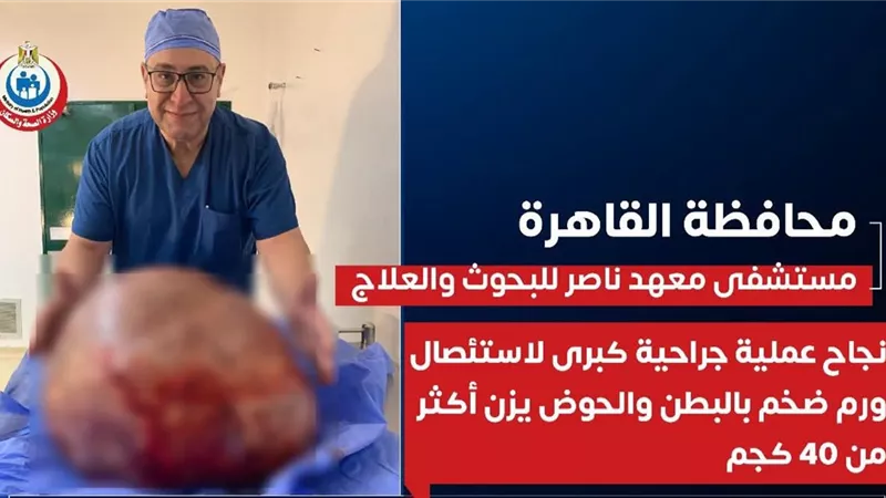 إنجاز طبي بمعهد ناصر.. استئصال ورم يزن 40 كيلوجرامًا من بطن سيدة