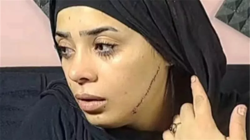 بعد ضرب عروس وإصابتها بـ41 غرزة بمصر القديمة.. مصدر أمني يكشف تفاصيل جديدة