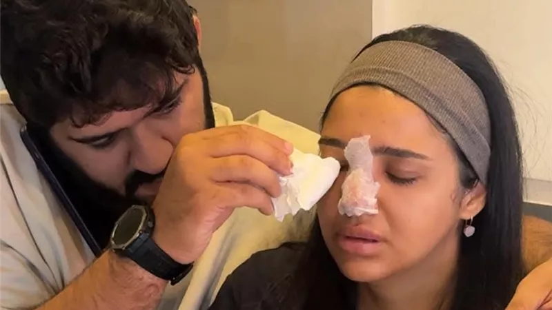 كنزي مدبولي تنشر صور صادمة بعد فشل حقنة فيلر