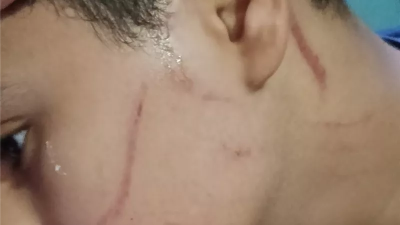 قطعوا وشه بقلم جاف .. سيدة تستغيث بعد الاعتداء على نجلها أمام مدرسة بالإسكندرية (صور)