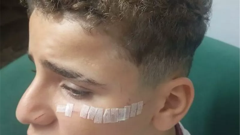 طالب يشوّه وجه زميله بـ