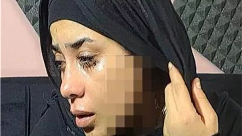 الحبس عامين لطليقة شوهت وجه عروس طليقها في مصر القديمة