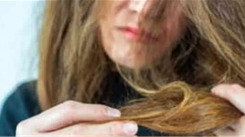 5 علاجات شائعة يجب تجنبها لحماية الشعر من التساقط