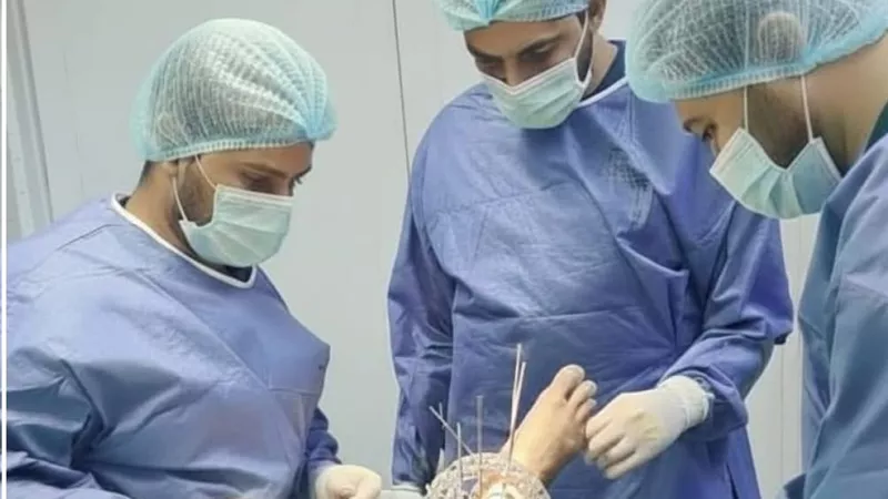 مستشفى الفكرية بالمنيا تجري أول عملية تثبيت خارجي بجهاز «إليزاروف» لمريض مُسن  