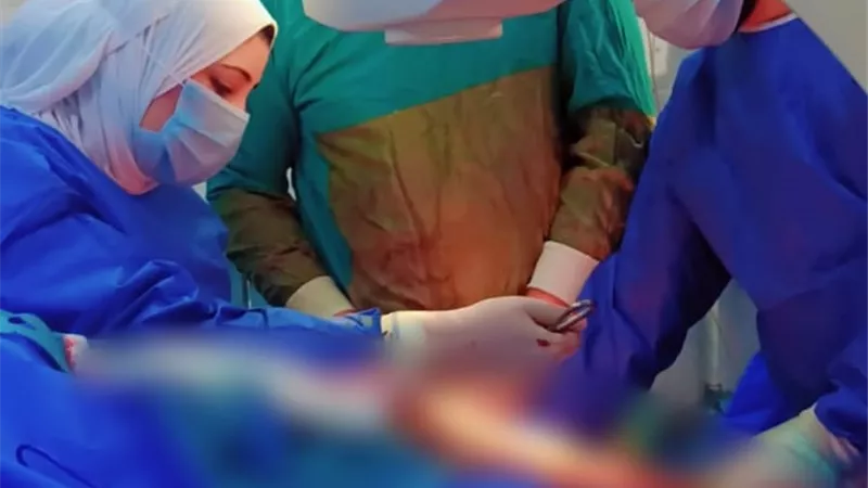 أثناء إجراء العملية