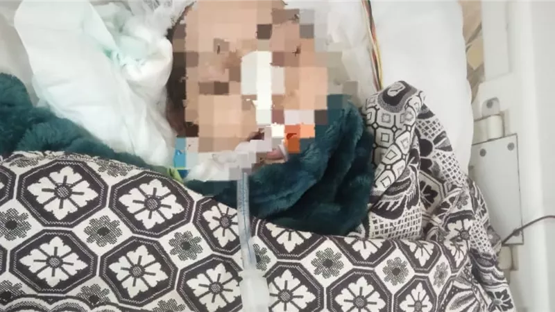 بعد معاناة طويلة.. وفاة سيدة بالمنيا مصابة بالتصلب الجانبي الضموري