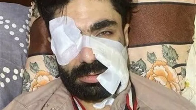 18 فبراير.. نظر جلسة تجديد حبس المتهم بالاعتداء على عمر عصام بطل الريست في الشرابية