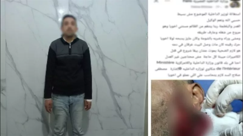 ضبط المتهم بالتعدي على شاب بـ