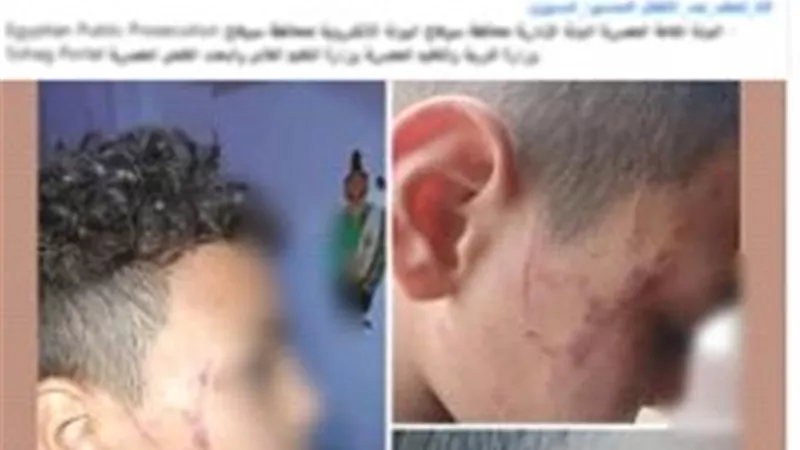 القبض على معلمة لتعديها بالضرب على طالب والتسبب فى إصابته فى الوجه بسوهاج