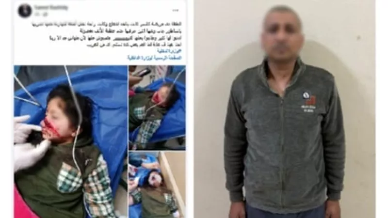 خلاف على محصول أرض ينتهي بتمزيق وجه طفلة بساطور في دمياط