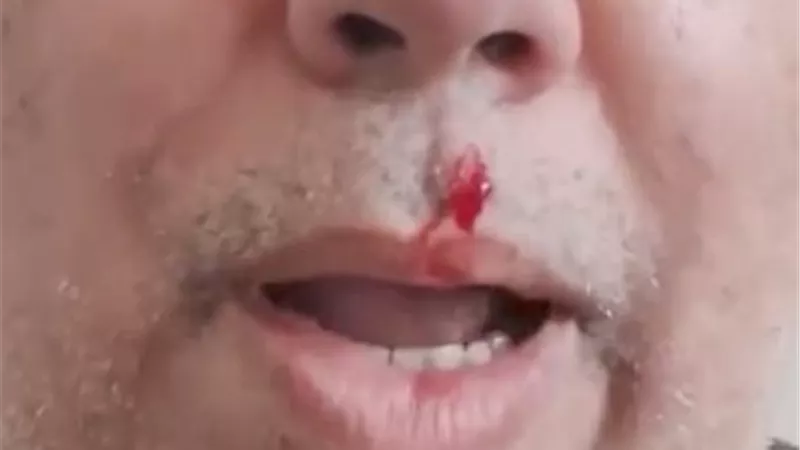 «نزيف وكدمات».. مدير مدرسة يضرب معلمًا داخل لجنة امتحانات بالإسكندرية| صورة