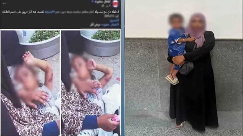 ضبط سيدة استغلت طفلتها المصابة بحروق في التسول أمام مطعم بالشرقية