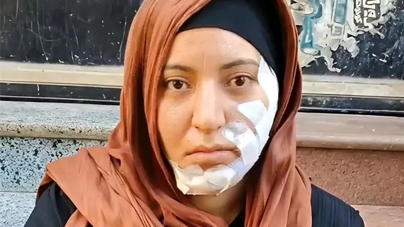 رفضت إشراكه في جمعية فاعتدى عليّ.. سمر تروي تفاصيل واقعة طعنها بالشرقية