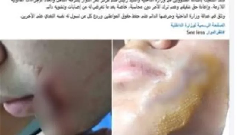بقطعة زجاج.. طالب يشوه وجه زميله في مشاجرة بالبحيرة 