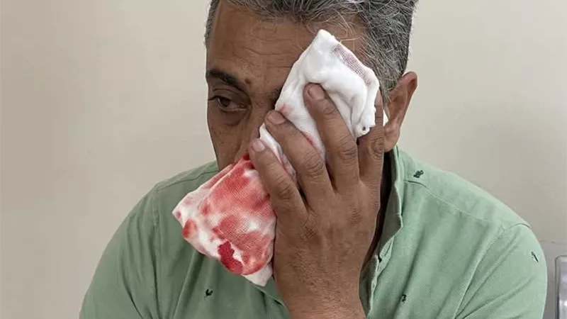 الشركة المعينة لحراسة مجمع الإسماعيلية الطبي تعتذر للمواطن المعتدى عليه 