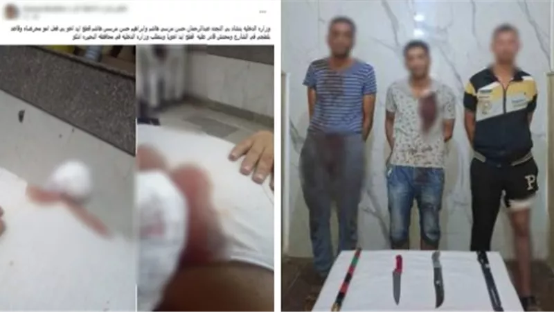 «بتر كف أحدهم».. كشف ملابسات مشاجرة بالأسلحة البيضاء بين أشقاء في البحيرة