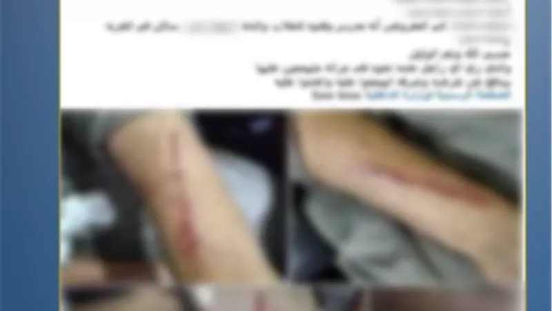 ضبط شخص وزوجته وآخرين لاتهامهم بالتعدي على شقيقه بسبب خلافات الميراث بالشرقية