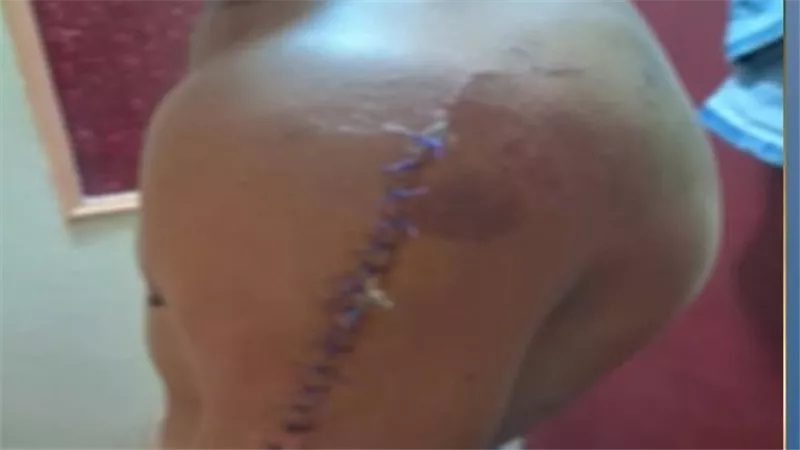 مزاح ينهي صداقة العمر.. شابين يعتديان على بعضهما بأسلحة بيضاء في المعادي 