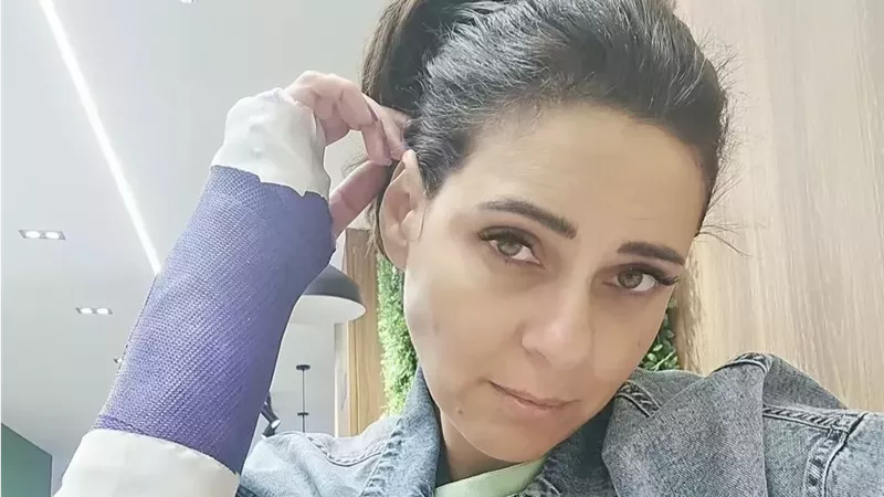 الفنانة نورهان شعيب تعلن إصابة يدها: لا مفر من الجبس