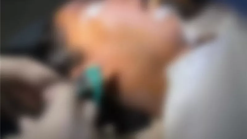 إنهاء معاناة مريضة من آلام الفك.. نجاح تدخل جراحي دقيق بمستشفى صدر المنيا